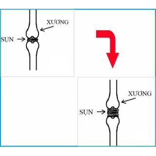 Tập Thể Hình Có Bị Lùn Không