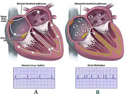 cách đo nhịp tim trên máy chạy bộ tại nhà
