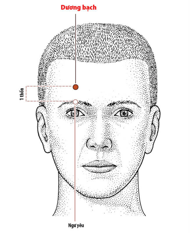 Huyet-tren-khuon-mat-o-nhung-vi-tri-nao-3