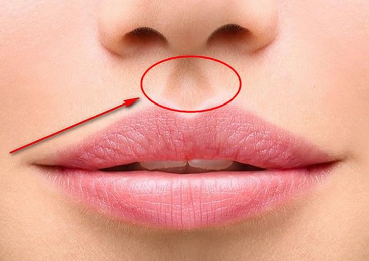 Huyet-tren-khuon-mat-o-nhung-vi-tri-nao-7