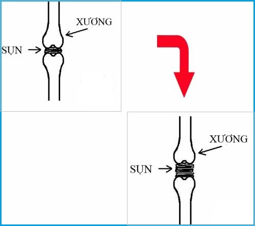tập tạ có lùn không