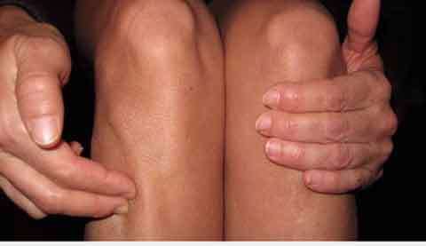 tram-cam-la-gi-cach-tri-tram-cam-khong-can-dung-thuoc-3