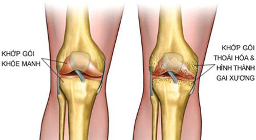 tac-dong-thap-len-xuong-khop